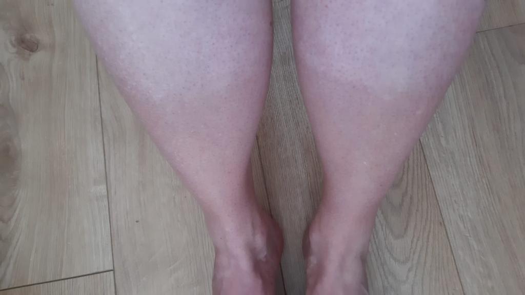 LynneMSimpson's tweet photo. @bloobloons It is too hot to do anything else. I am proudly showing off my running capri tan🤐 https://t.co/0HQj2lVNkT