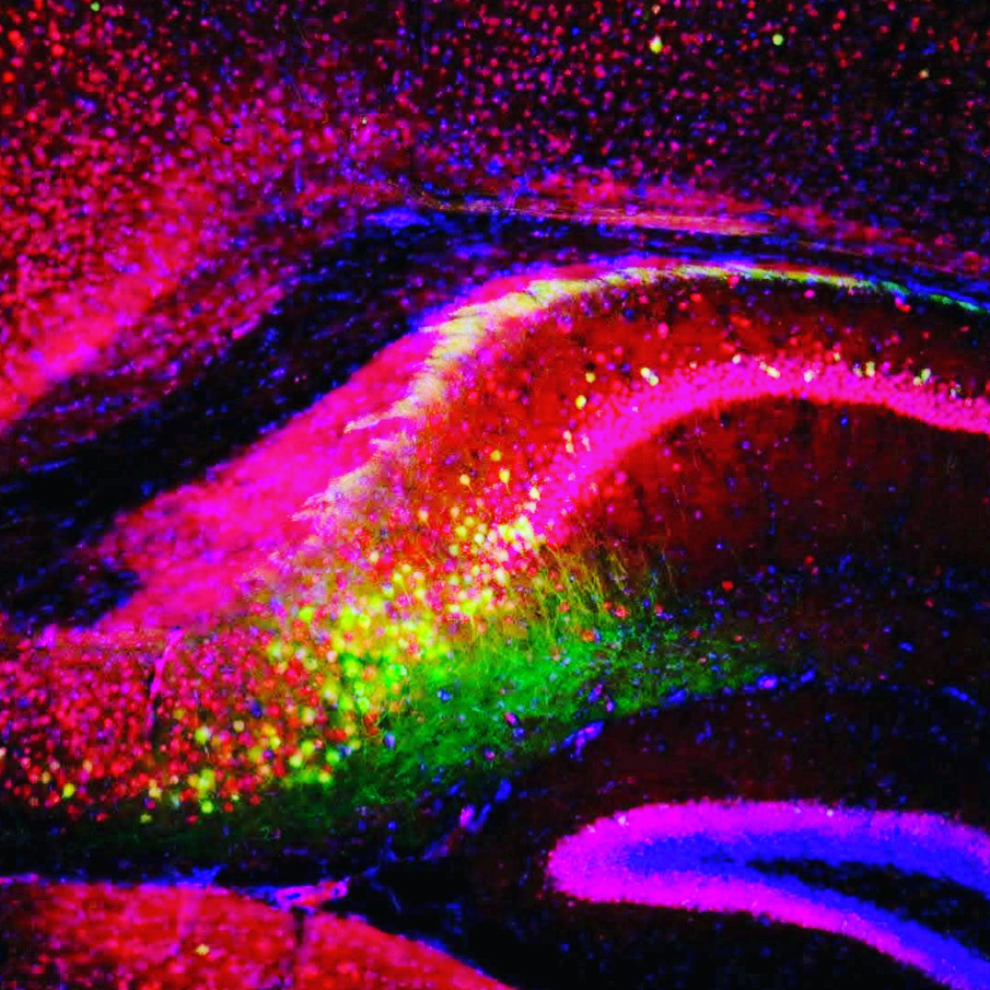E11BIO's tweet photo. Some of our first brain images coming off our microscope #FluorescenceFriday 

#neuroscience #brain #connectomics https://t.co/jli3E2kYuJ