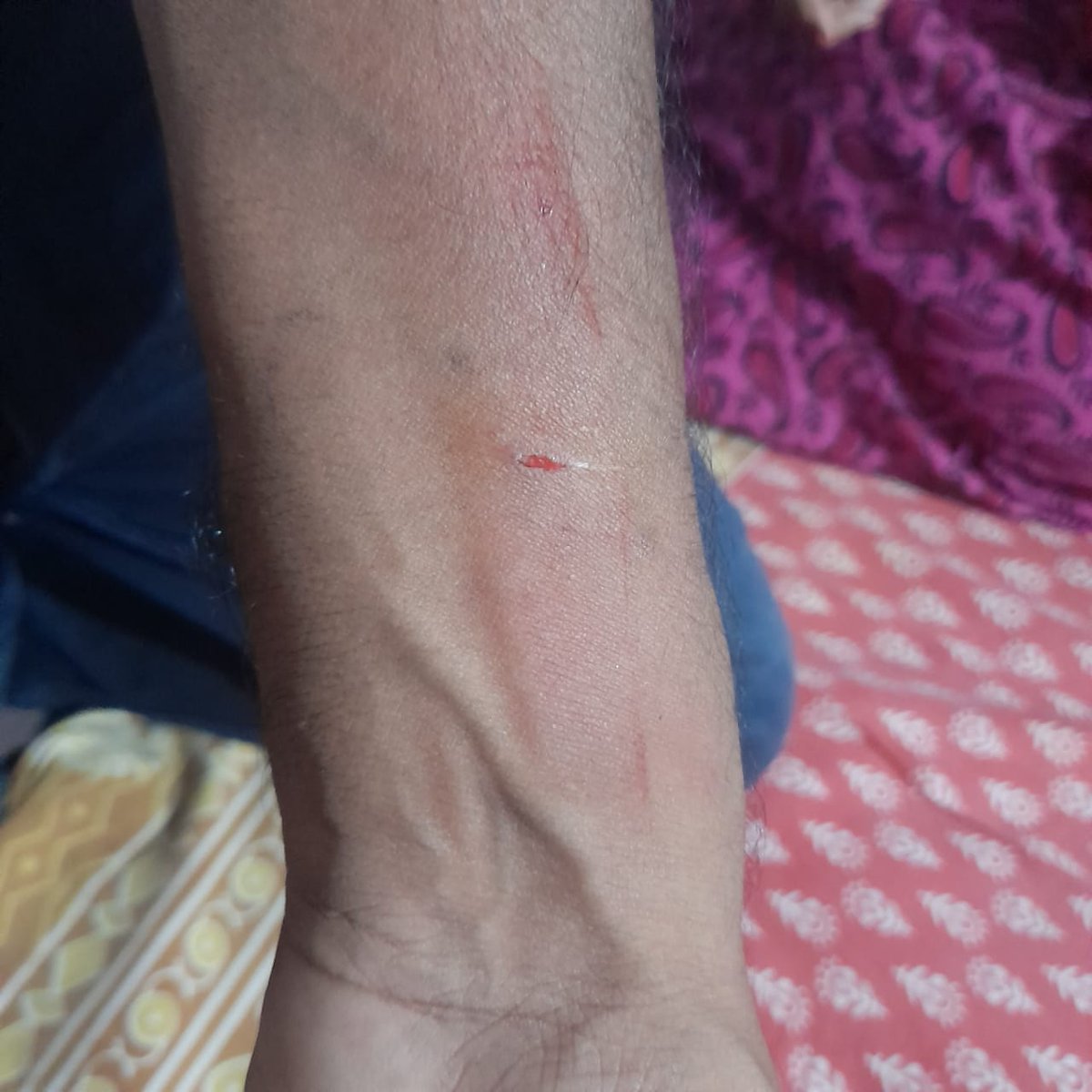 PramodBPathak's tweet photo. @DixitSwechha @PMOIndia @CMOfficeUP @myogioffice @Uppolice @myogiadityanath Today approx 5 days has passed.But as per Victims family No satisfactory Action has been taken by the official authorities. No FIR No Medical.Request all for quick n Prompt action through proper channel for justice to @DixitSwechha family.@dgpup 🙏🇮🇳जय हिंद https://t.co/lKm0u3R4Mf