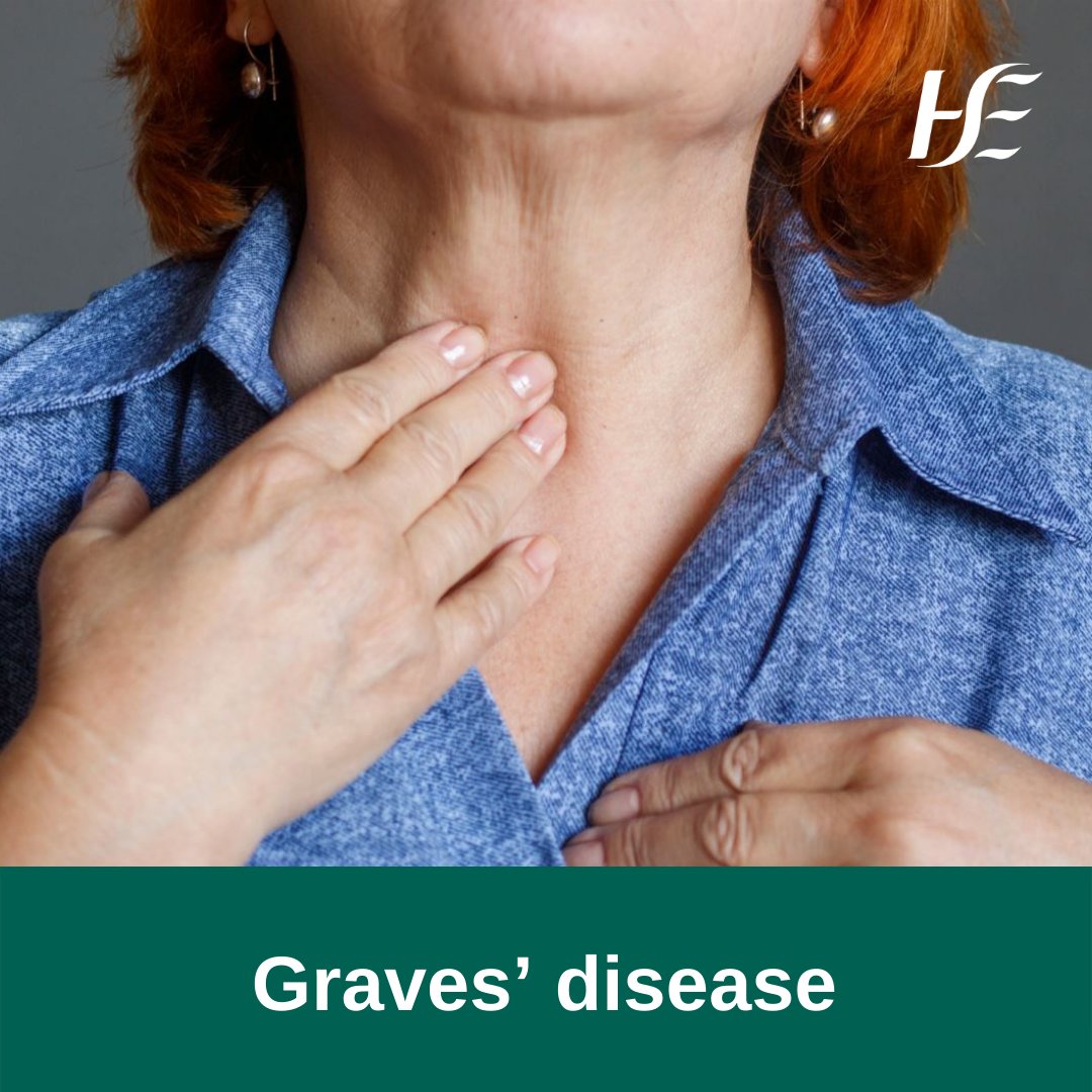 HSELive's tweet photo. An #OveractiveThyroid happens when your thyroid gland produces too much thyroid hormone. In around 3 in every 4 cases, an overactive thyroid is caused by a condition called Graves' disease. This is an autoimmune condition.
Learn more about #GravesDisease: https://t.co/lWJiJyPmIO https://t.co/kDeARrBrsY