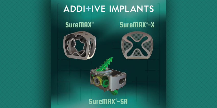 Ryortho1's tweet image. First implants of a notably creative family of 3D printed spacers for cervical spine fusion. Designed and Mfg’d by Additive Implants. ryortho.com/breaking/first… 

#AdditiveImplants #spine #PawelJankowski #HoagHospital #otw #orthopedicsthisweek #orthopedics