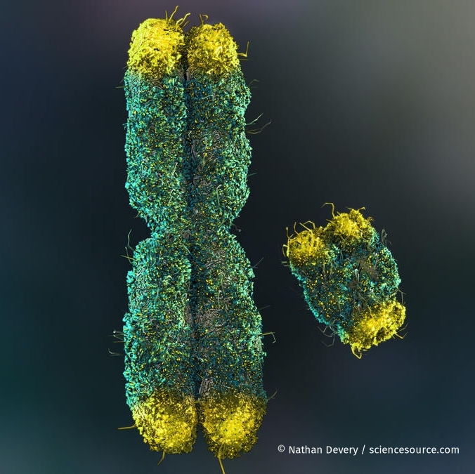 ScienceSource's tweet image. Telomeres - check out the article with our image used by @sciencemagazine
"Men lose Y chromosomes as they age. It may be harming their hearts" - Study tests health effects of losing male chromosome
science.org/content/articl…
© Nathan Devery/Science Source
#telomere #telomeres