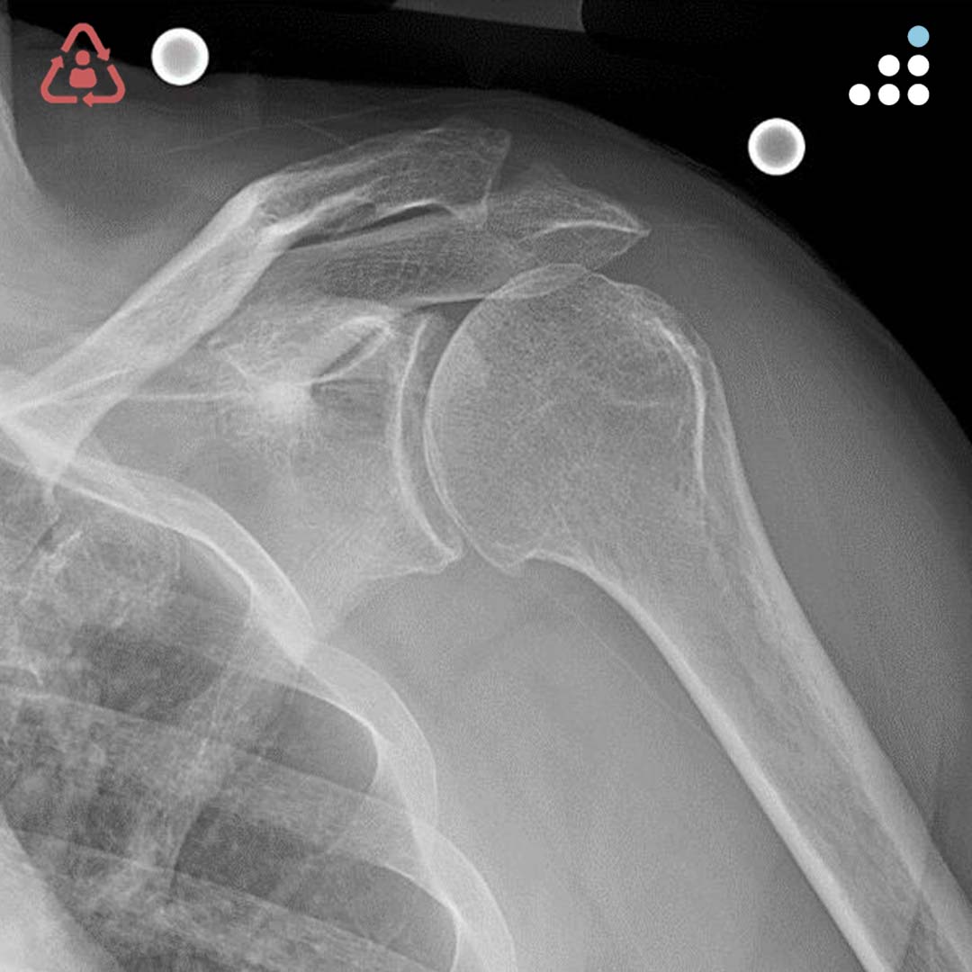 Orthobullets tweet media