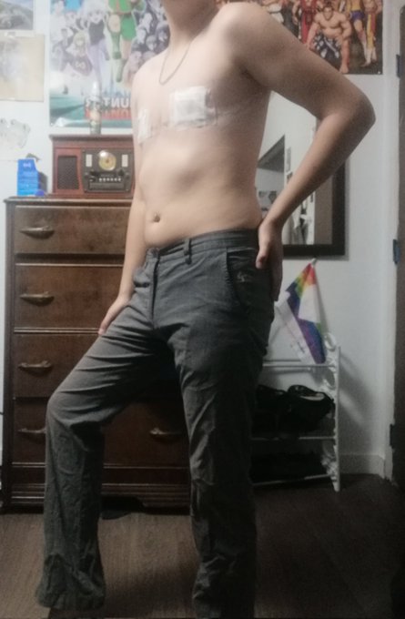I love these pants sm. This is what I call my dreamy 80s queer boy outfit haha #trans #queer #queermen<a href="/tag/80s"class="tags"><span>#80s</span></a><a href="/tag/queer"class="tags"><span>#queer</span></a><a href="/tag/trans"class="tags"><span>#trans</span></a><a href="/tag/queermen"class="tags"><span>#queermen</span></a>