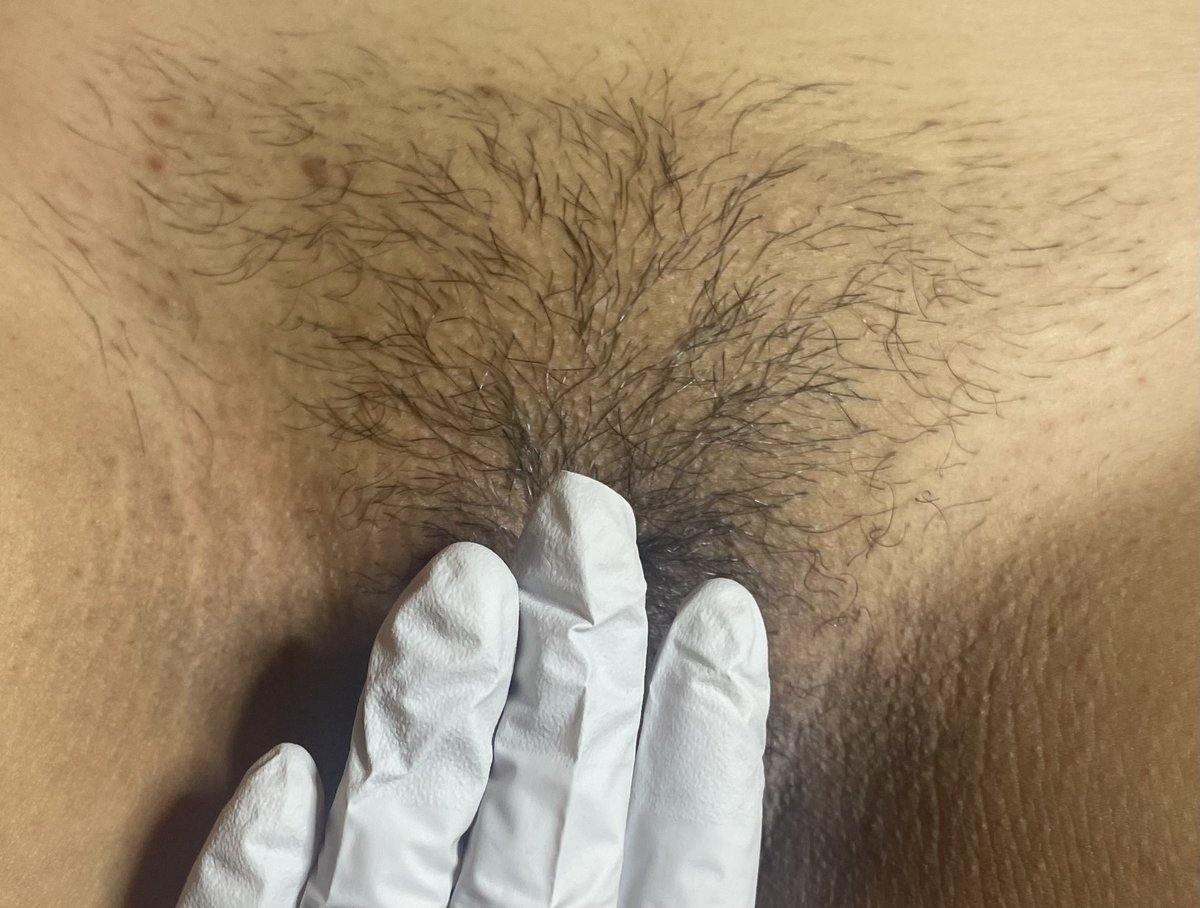 HoodSthetics's tweet photo. Brazilian 💁‍♀️

It’s too hot in Texas to have any body hair that isn’t on your head or brows 

Dm to book your service 💜

Ig: @ Hood.Sthetics https://t.co/Cvjzr3HuIi