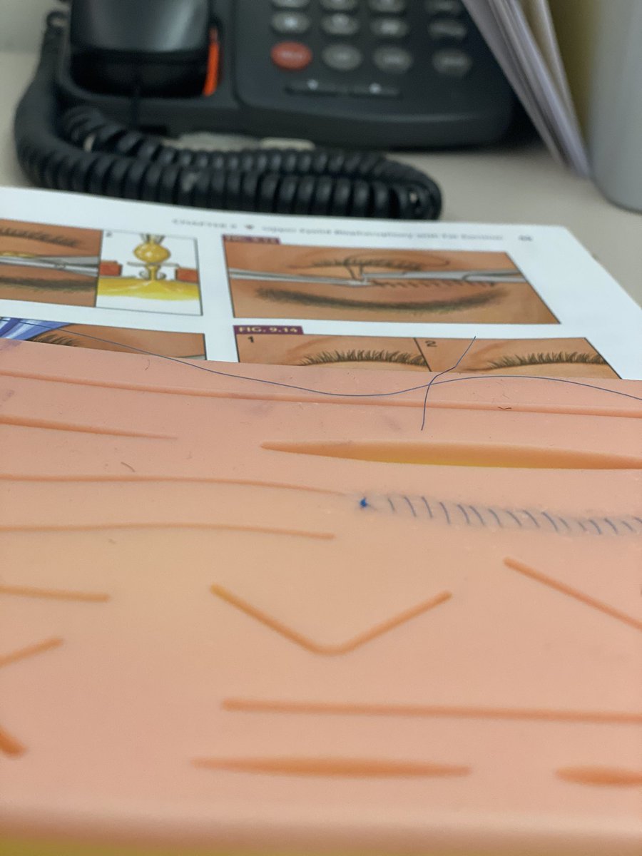 Taking notes for the day where I’ll be an attending, PD, or Chair and a visiting student wants to “experience” the surgical procedures. Dr. Pham made sure I had the proper tools to do so. [Study->Watch-> Practice ->Repeat]
 #oculoplastics <a href="/uiowaeye/">UIowa Eye</a>  #ophthalmology #ophthotwitter