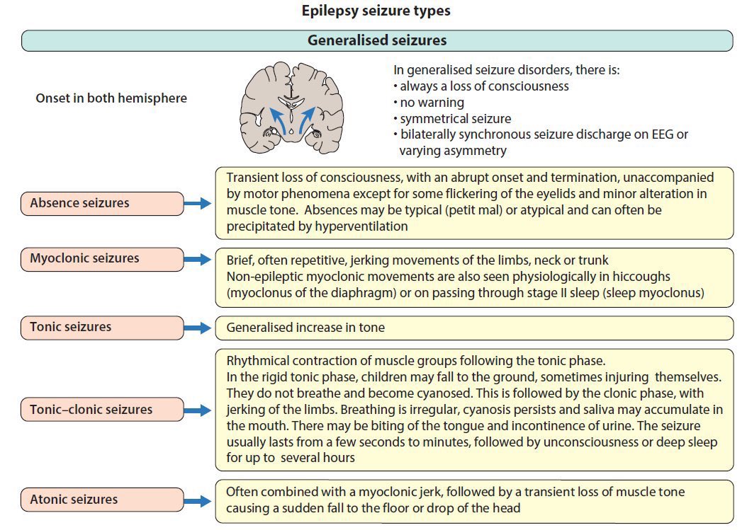 OGdukeneurosurg's tweet photo. Do you know how to Diagnose the type of Seizure? https://t.co/8b0vtb4Gty