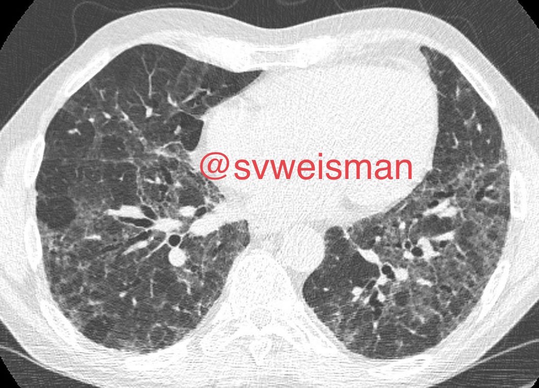 Stacey Verzosa Weisman, MD tweet media