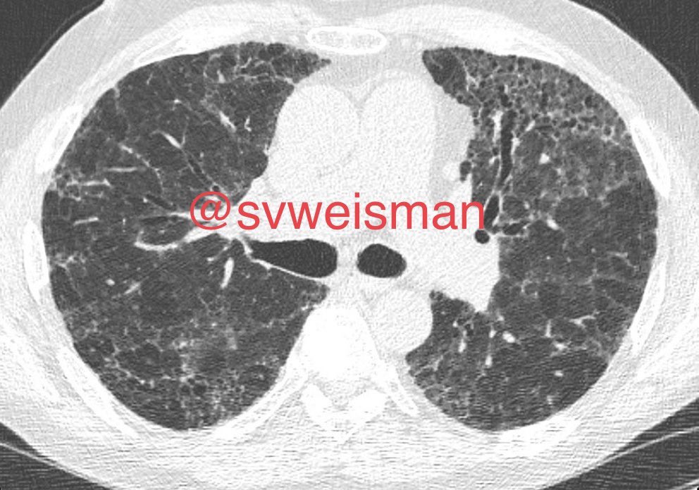 Stacey Verzosa Weisman, MD tweet media