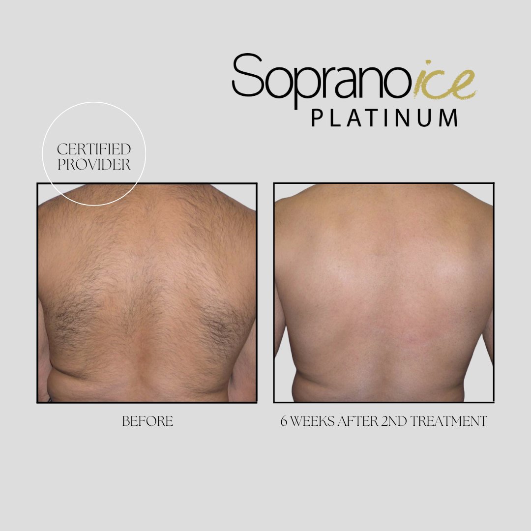 @dermaspa_mk tweet media