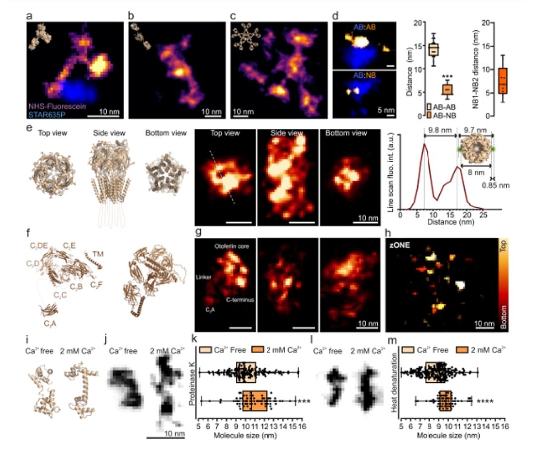 😍 Holy Moly! <a href="/AliHShaib/">Ali H. Shaib</a> just established ONE, a method combining #ExM and #SRRF to achieve one nanometre resolution imaging on most microscopes! Figures are beyond super!! Congratulations everyone, can't wait to try it