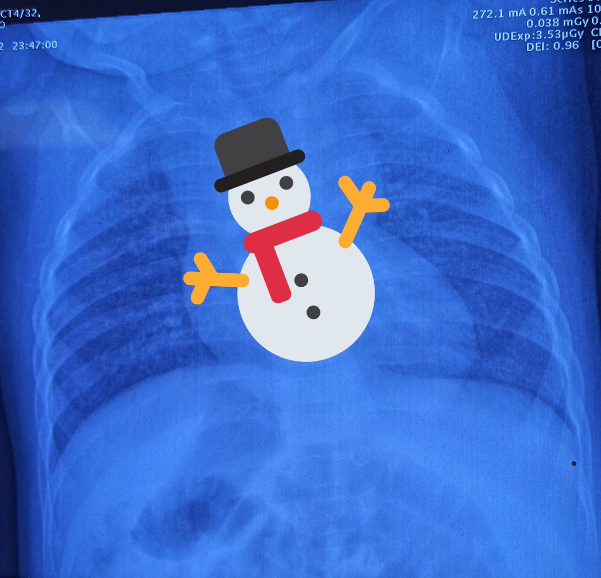 Jyoti_Kuku's tweet photo. Two snowmen, But huge differences! 😀
#TAPVR #Cardiology #aiims #MedTwitter https://t.co/J38QwRjOdS