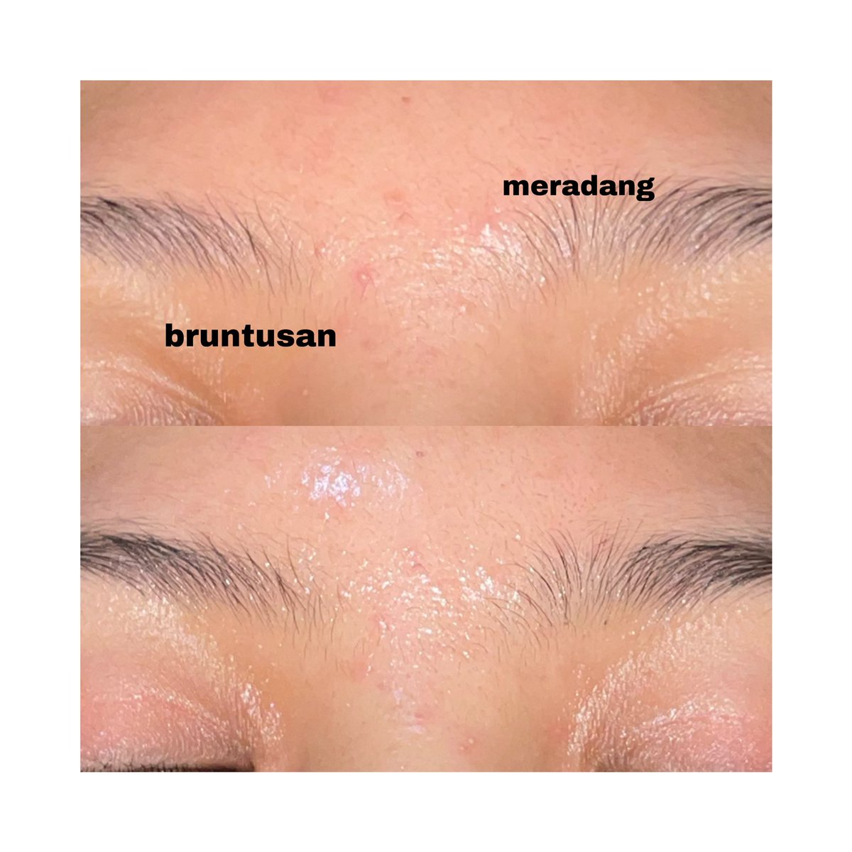 azeclair's tweet photo. Siapa yg sering bruntusan atau dapet jerawat pasir? Solusinya cuman pake exfo toner yg sekaligus punya manfaat hydrating dan soothing👍

Aku rekomendasiin toner gentle tapi paling bisa diandelin nih

✨Teratu Beauty PHA Gentle Exfoliating Toner✨

#racuninskincare https://t.co/zSGQqrHJzT