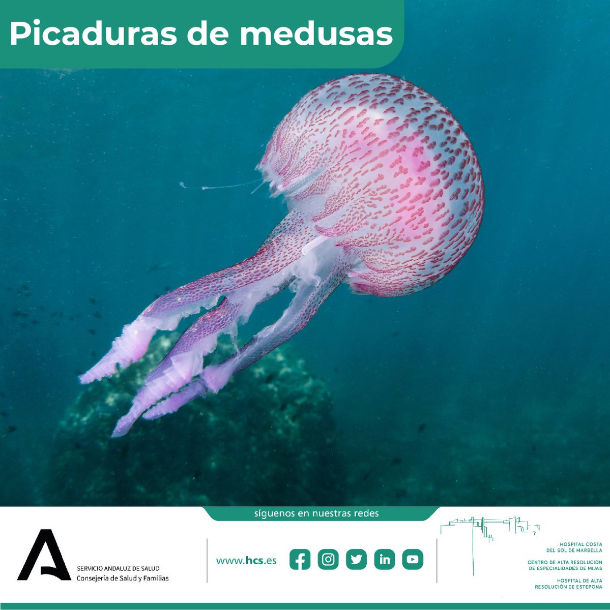 ASCostadelSol's tweet photo. 🌊 Agosto es el mes por excelencia para disfrutar de nuestras playas, pero sabemos que las medusas también hacen su aparición. Toma nota de lo que debes hacer si sufres una picadura:

Dentro hilo 👇 https://t.co/6ghF9EkJno