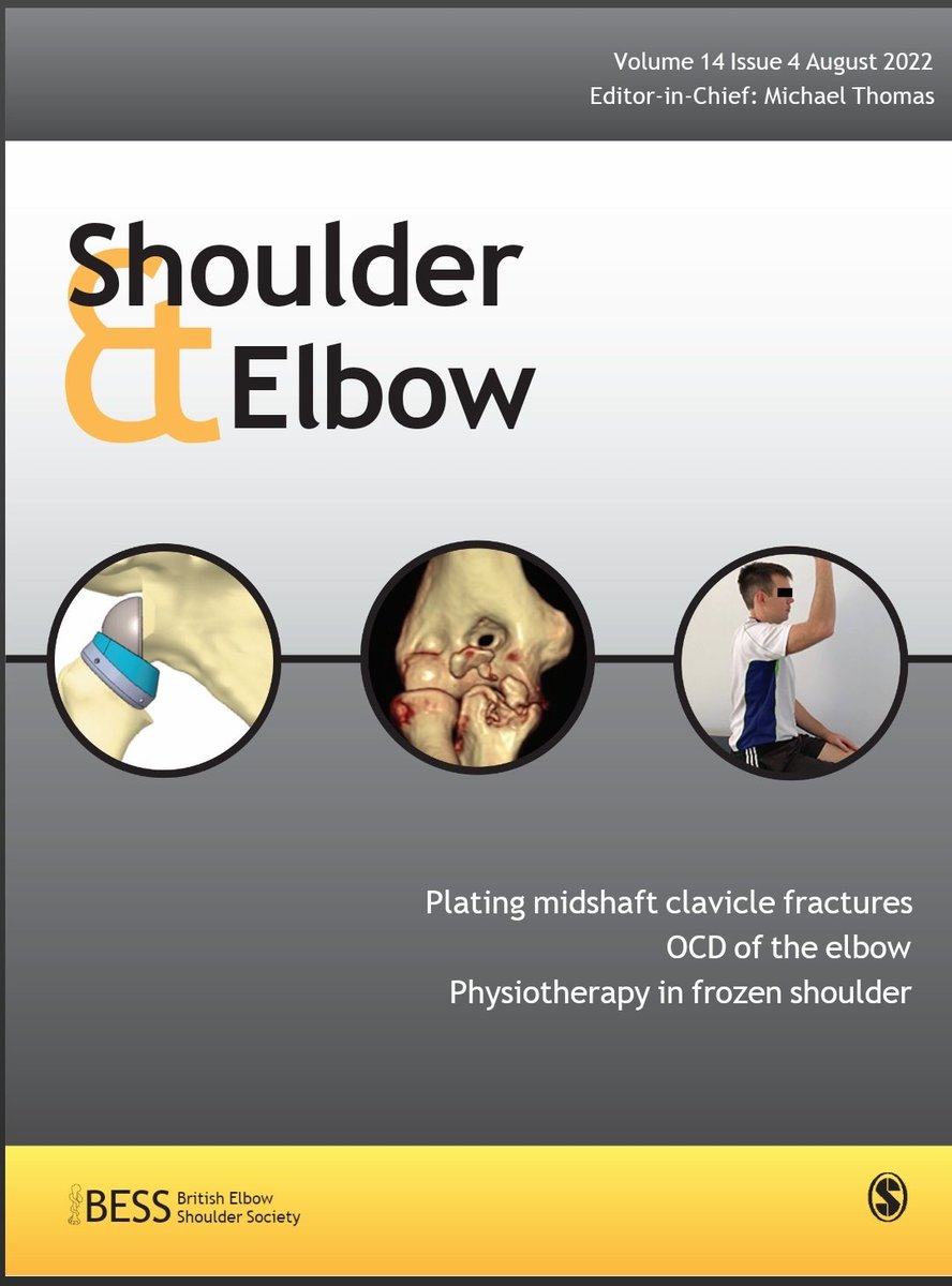 SpOrthopod's tweet image. Read our multicentre review &amp;amp; guidance on management of #elbow trochlea OCD in current issue of @ShoulderElbowJ. A rare pathology with little info in literature.

Presented @bessconference June 2021 

doi.org/10.1177%2F1758…

#orthotwitter #Orthopaedics @WorcsAcuteNHS @uhbtrust