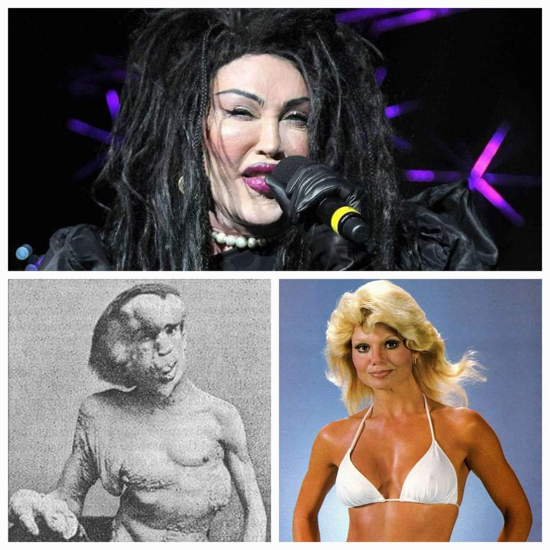 Happy Birthday to Pete Burns, Joseph Merrick, and Loni Anderson! 