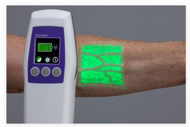 Venöz erişimi zor hastalarda,damar görüntüleme teknolojisini kullanan hastaneler var mı ? Eldiven bile zor bulurken bu teknoloji şaka gibi geldi bana 🤦🏼‍♀️