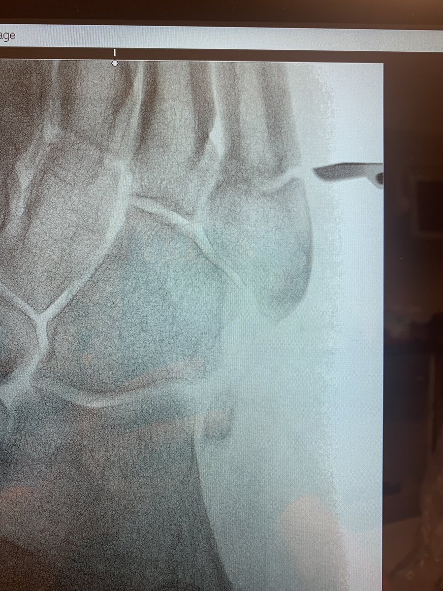 Christopher Miller, MD, MHS, FAAOS tweet media