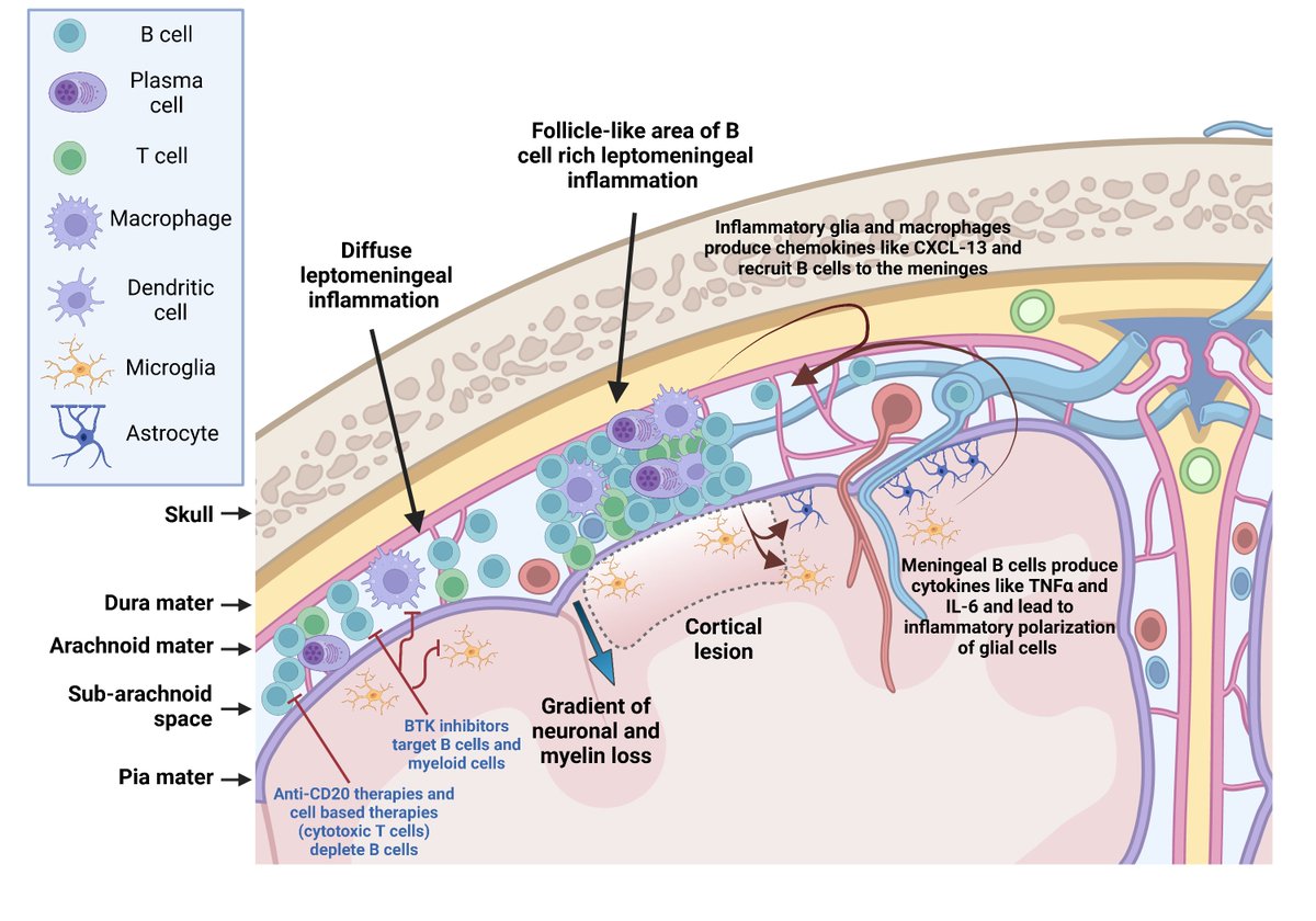 Brain1878's tweet photo. Bhargava et al. review the role of B cells in mediating cortical demyelination and neuronal damage in multiple sclerosis, and discuss treatment strategies that could be used to target pathogenic B cells. https://t.co/DV5Wbavg4a https://t.co/d3f8koN9b2