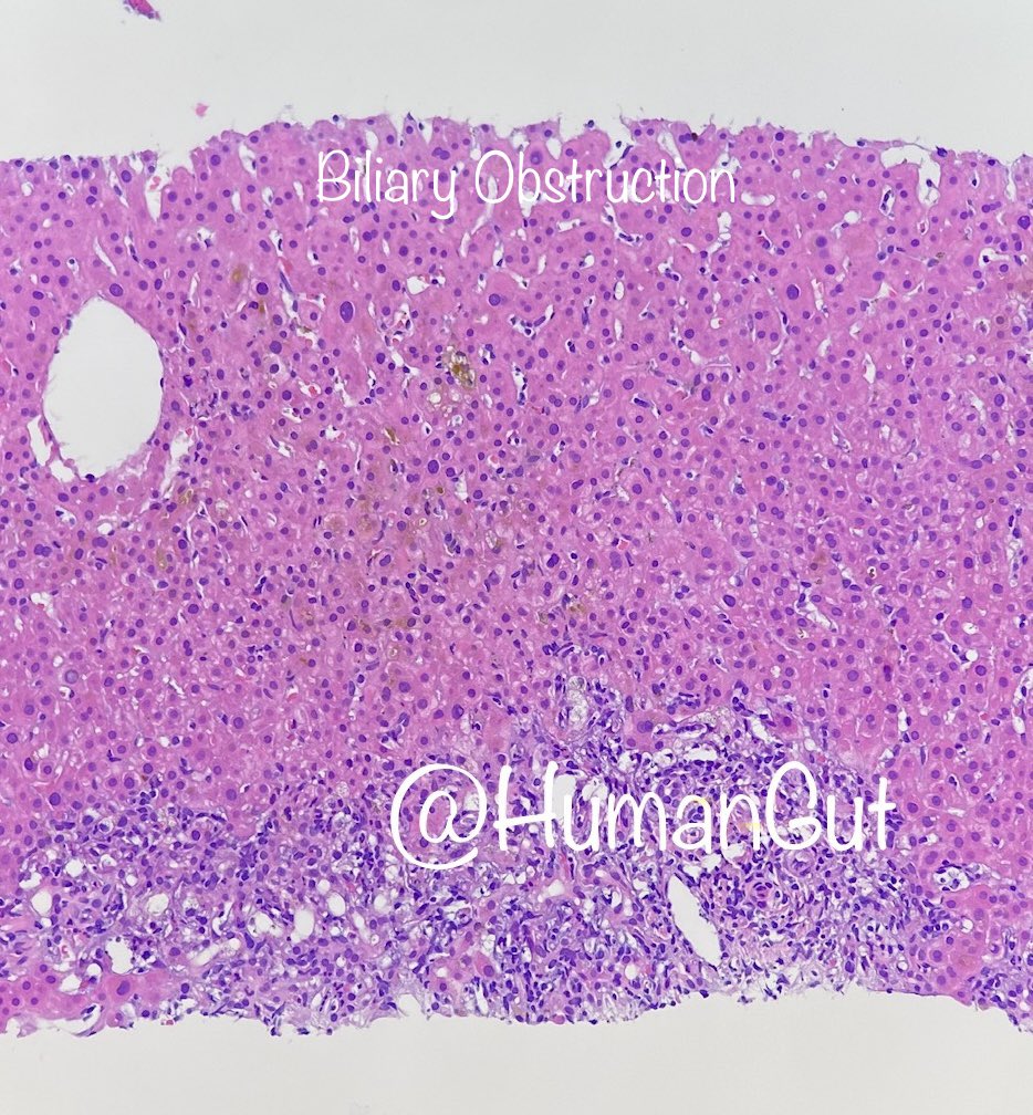 HumanGut (@humangut) on Twitter photo 