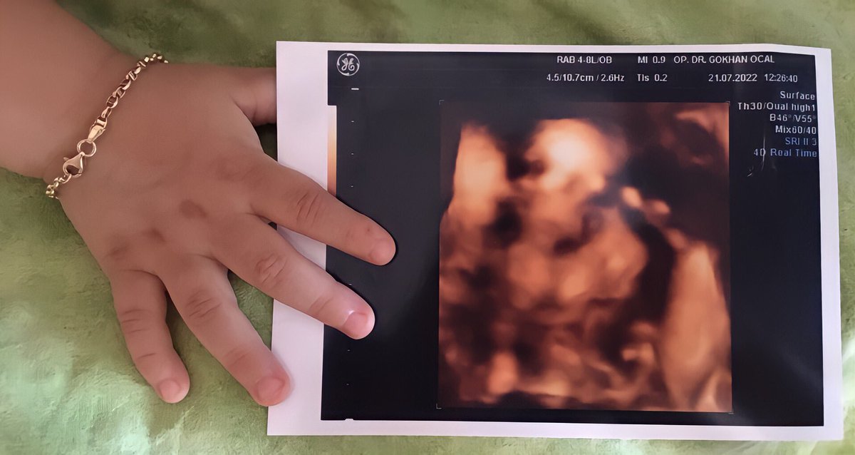 Bi çiçek bi böcek ❤️