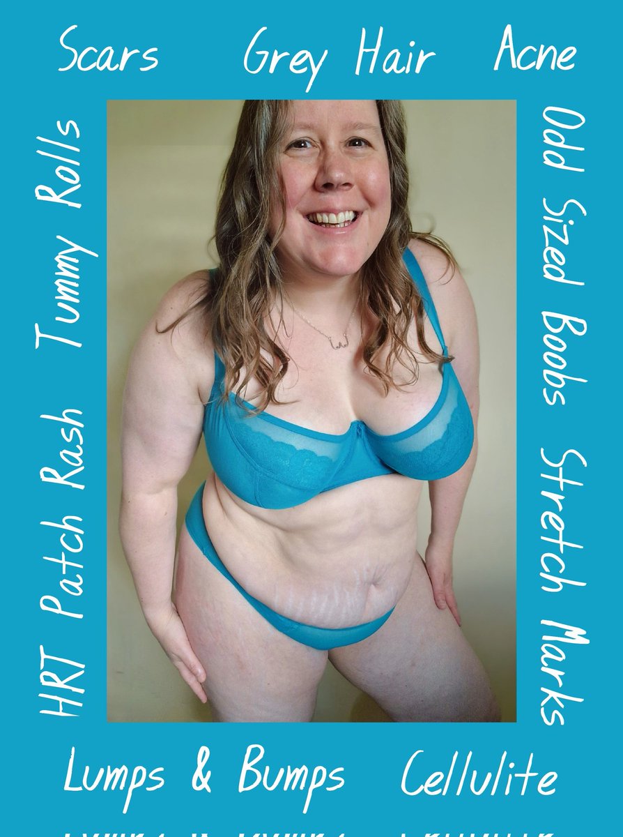 emmajg's tweet photo. This is me, this is a normal body.
#SelfCareSaturday #normalisenormal #normalizenormal https://t.co/SBUdqaNJ6N