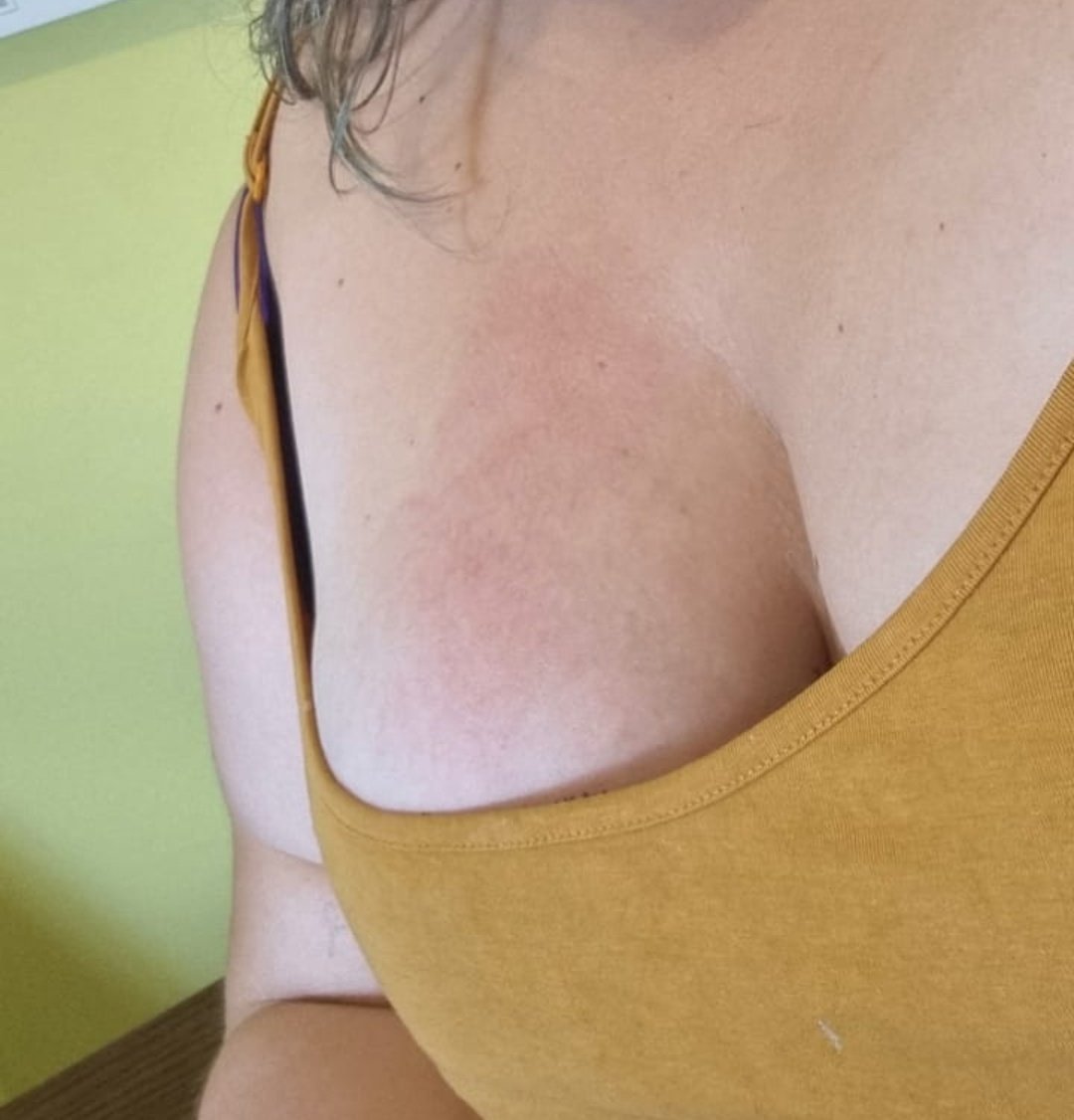 BBWPrincessJade's tweet photo. Every β‘= 1 slap. Every retweet = 2 slaps.. Every new follow = 3 slaps... you got until 10pm to get my titties red raw... i will upload video evidence tonight π€ͺ #Slut #TakeControl #SlappedIntoSubmission #BBWSubSlut #Titties #OwnMe https://t.co/QdOUCevVT6