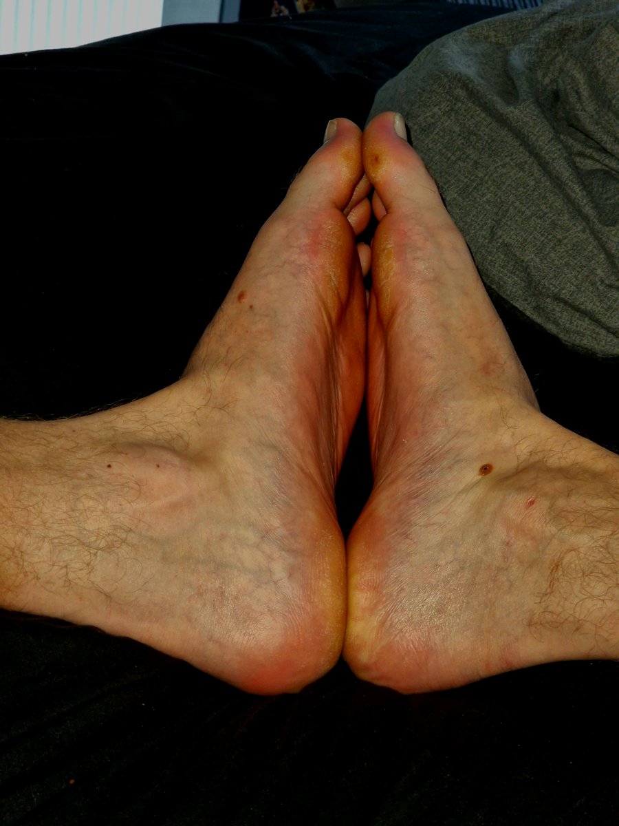 Manfeet369's tweet photo. #feet #malefeet https://t.co/kxPH0JLAA6