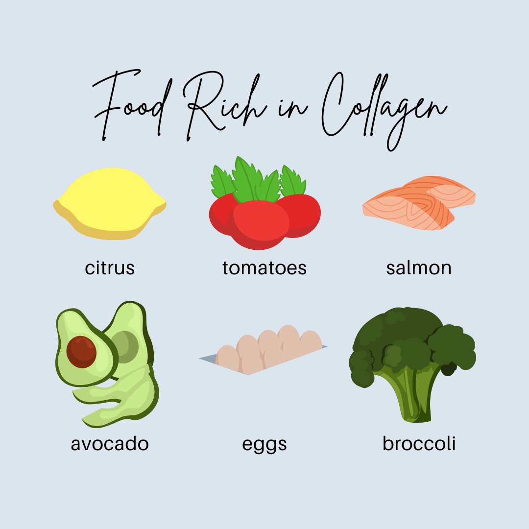 DrEddyClinic's tweet photo. RT @DrMyraReed: Collagen is responsible for healthy joints and skin elasticity. Here are six foods that you can consume that will help the health of your skin!🥦
#panamacitybeach #panamacity #30A #wellness #floridadoctor #seaside #pcb #visitpcb #drm… https://t.co/NIPpRagXfd