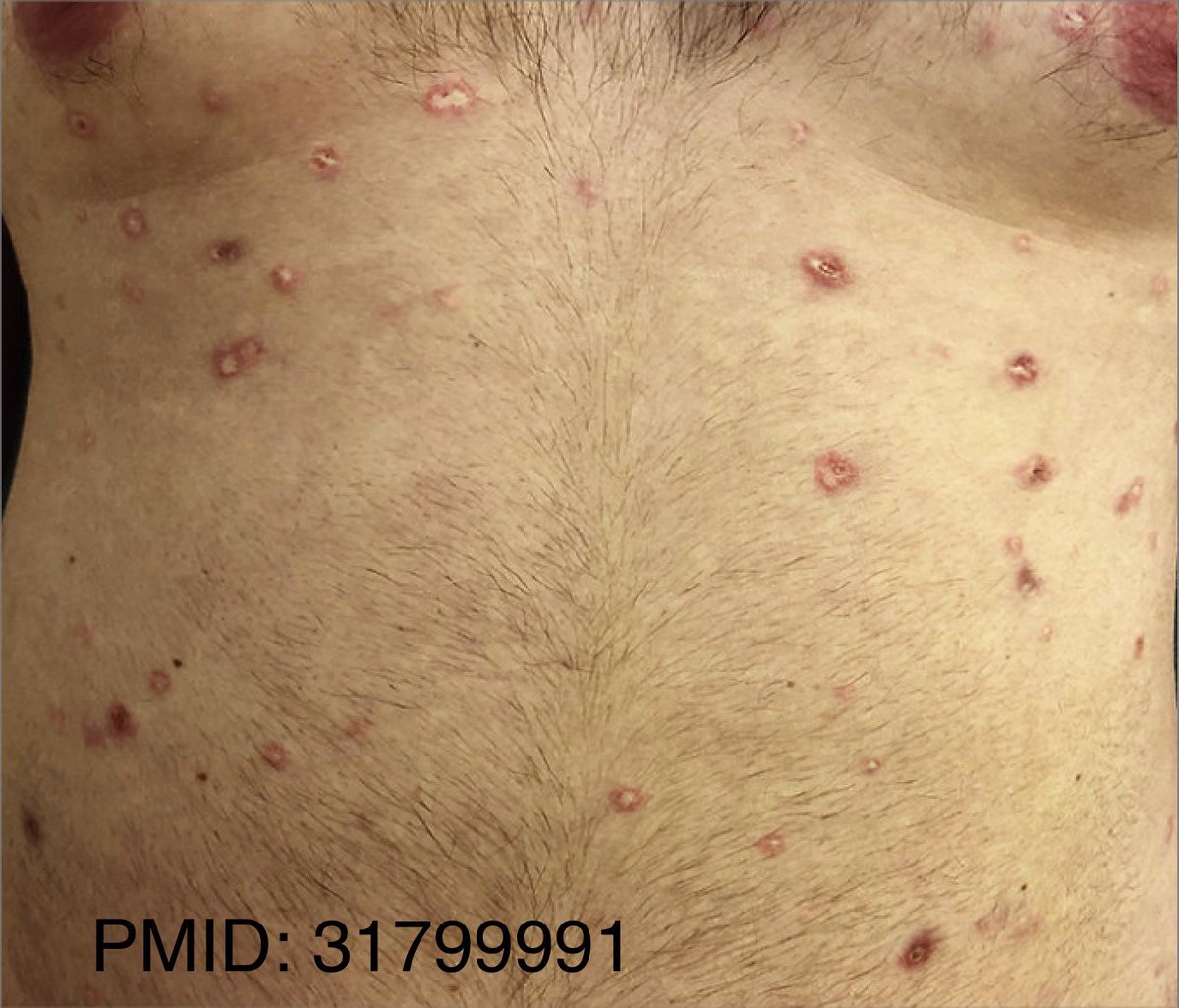 HovAsh3's tweet photo. Question 2! #dermtwitter #MedTwitter #dermatology #MedEd https://t.co/fTgdlQ833v