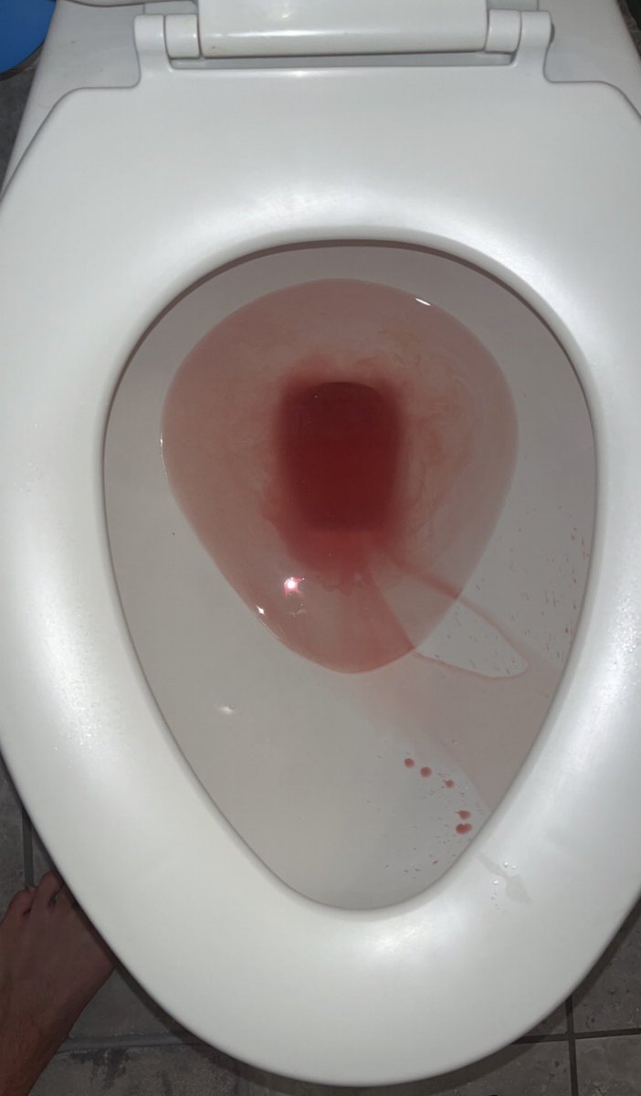 y'all ever just wake up and pee blood😂, image size:702x1200