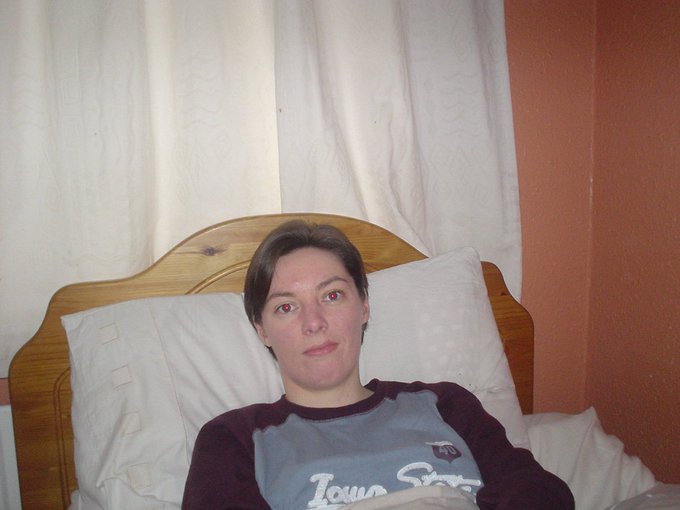 On #SevereMEday (Aug 8), I remember my friend Ruth Nolan from Glasnevin, Dublin who has spent 3 decades bedbound with #SevereME

For 13+ yrs she has had #VerySevereME:she's only able to have a few very short conversations & very little cognitive/mental stimulation☹️

#MEcfs #PwME