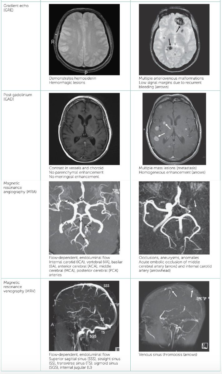 #MRI sequences in the #brain 
Credit:Essentials of Internal Medicine
#radiology #radiography #FOAMrad #radres #neurotwitter  #radtwitter #MedTwitter #MedEd #INNOMed #FOAMed
