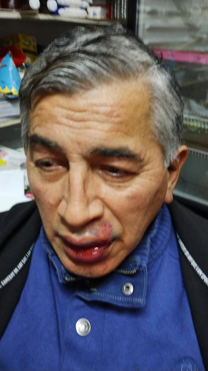 MarieSchaab's tweet photo. En el McDonalds Plaza Oeste de Morón, un empleado golpeó brutalmente a mi papá. Le abrió la boca a golpes x NO SABER USAR EL AUTOSERVICIO p hacer el pedido!
@McDonalds_Ar hacete cargo de esta situación YA!
La denuncia ya está asentada en la Comisaría
Retweet porfa 🙏 https://t.co/1Nc1PtWa5W