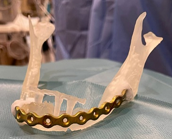 FabLab 3D Hospital Marañón tweet media