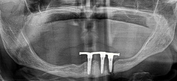 FabLab 3D Hospital Marañón tweet media