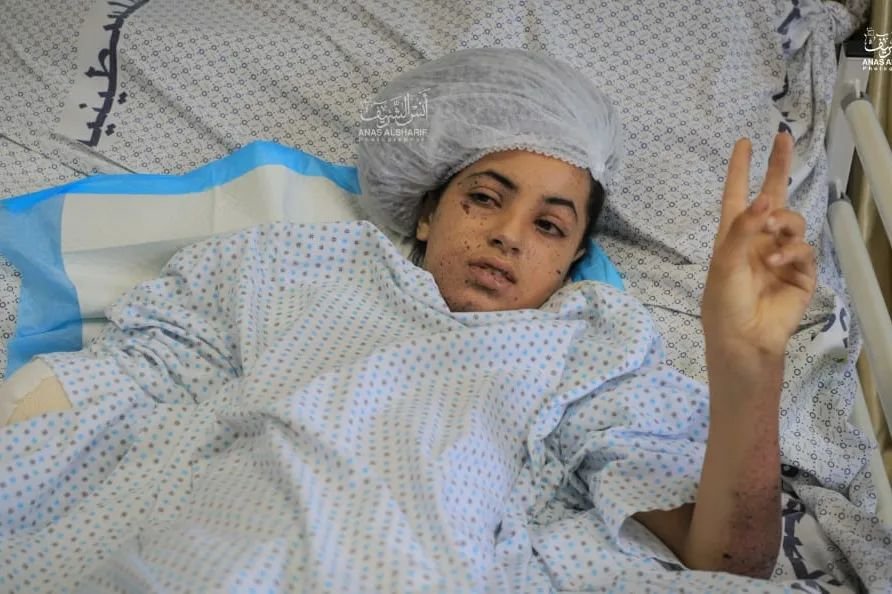 Palestinell's tweet photo. The Palestinian girl Rahat Suliman (11) lost both of her legs and her arm in an Israeli airstrike on the Jabalia refugee camp, during the recent aggression on Gaza. 
#IsraeliTerrorism 
#IsraeliCrimes https://t.co/QoIi8YgQ50