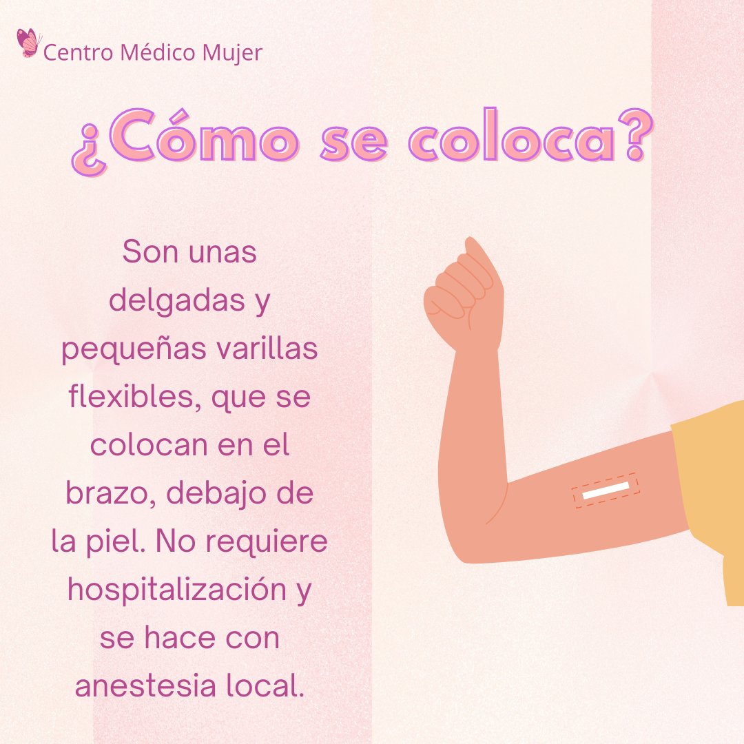 C_MedicoMujer's tweet photo. 👉Este método anticonceptivo es de LARGA DURACIÓN de 3-5 años por lo que no tendrás que preocuparte por un embarazo no deseado en ese lapso. 😍 En Centro Médico Mujer podemos colocártelo. Contáctanos para más información. 🌸
☎ 5555642290
📩 Envíanos Mensaje Privado
#plafam https://t.co/rmwVZVc3F5