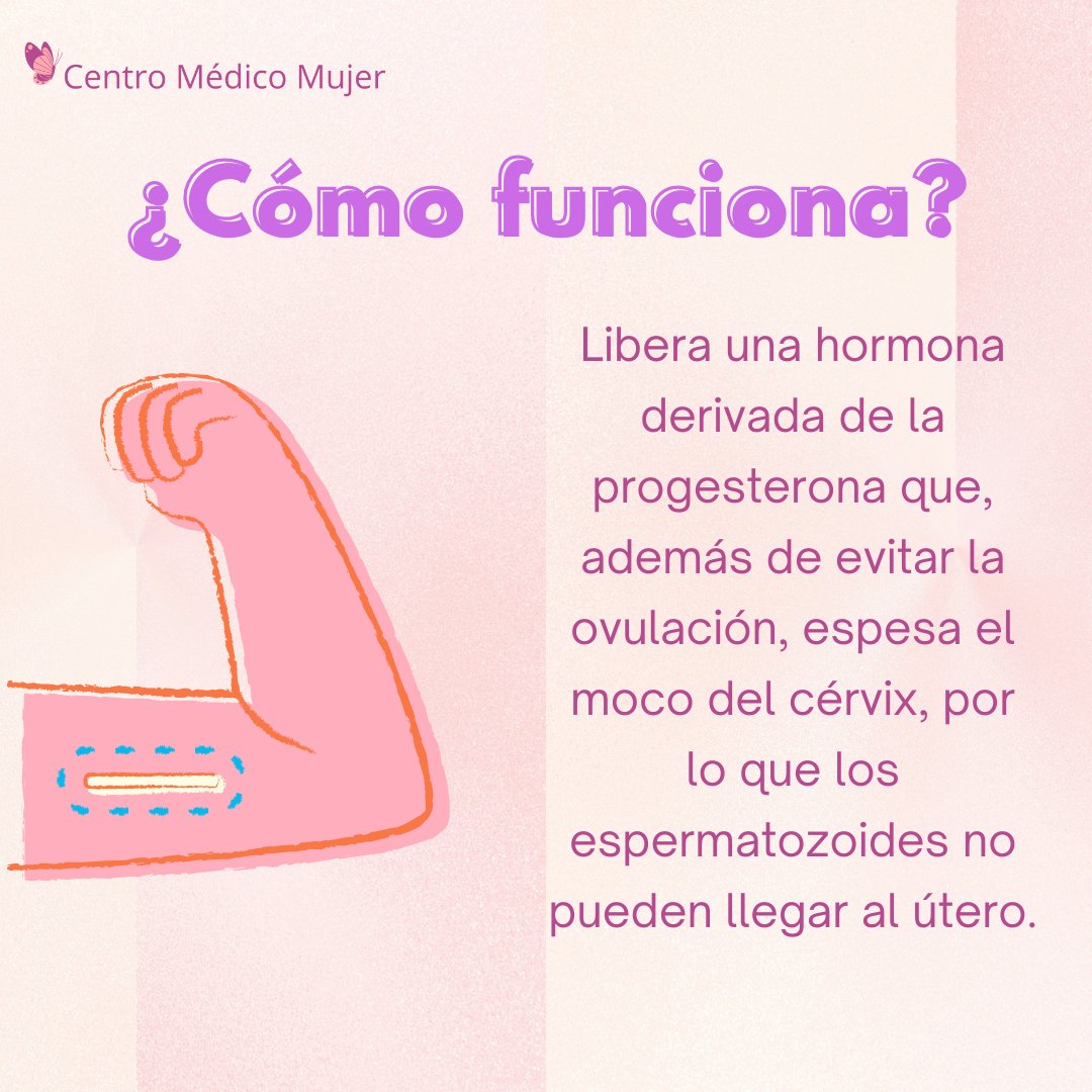 C_MedicoMujer's tweet photo. 👉Este método anticonceptivo es de LARGA DURACIÓN de 3-5 años por lo que no tendrás que preocuparte por un embarazo no deseado en ese lapso. 😍 En Centro Médico Mujer podemos colocártelo. Contáctanos para más información. 🌸
☎ 5555642290
📩 Envíanos Mensaje Privado
#plafam https://t.co/rmwVZVc3F5