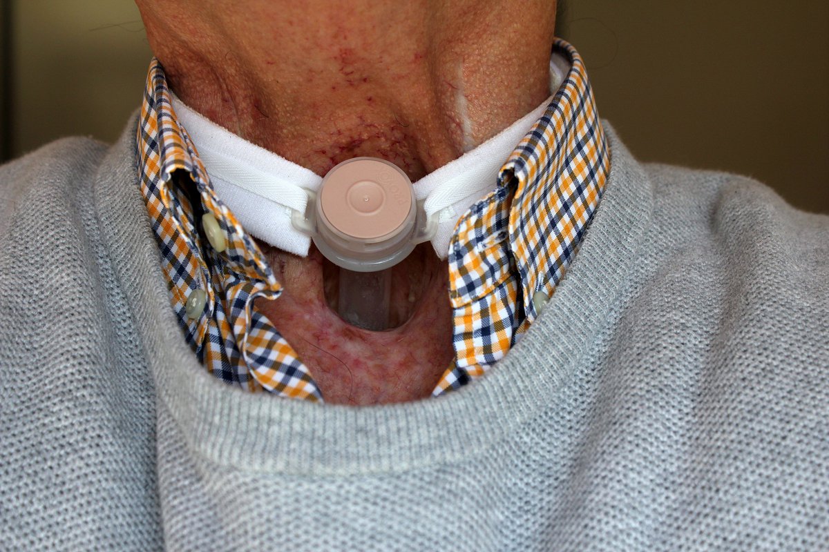 VoiceHealthOrg's tweet photo. Early detection of benign and malignant laryngeal lesions can help preserve one's voice and be lifesaving. #voicehealth #savevoice https://t.co/pEWRjJ5UK1