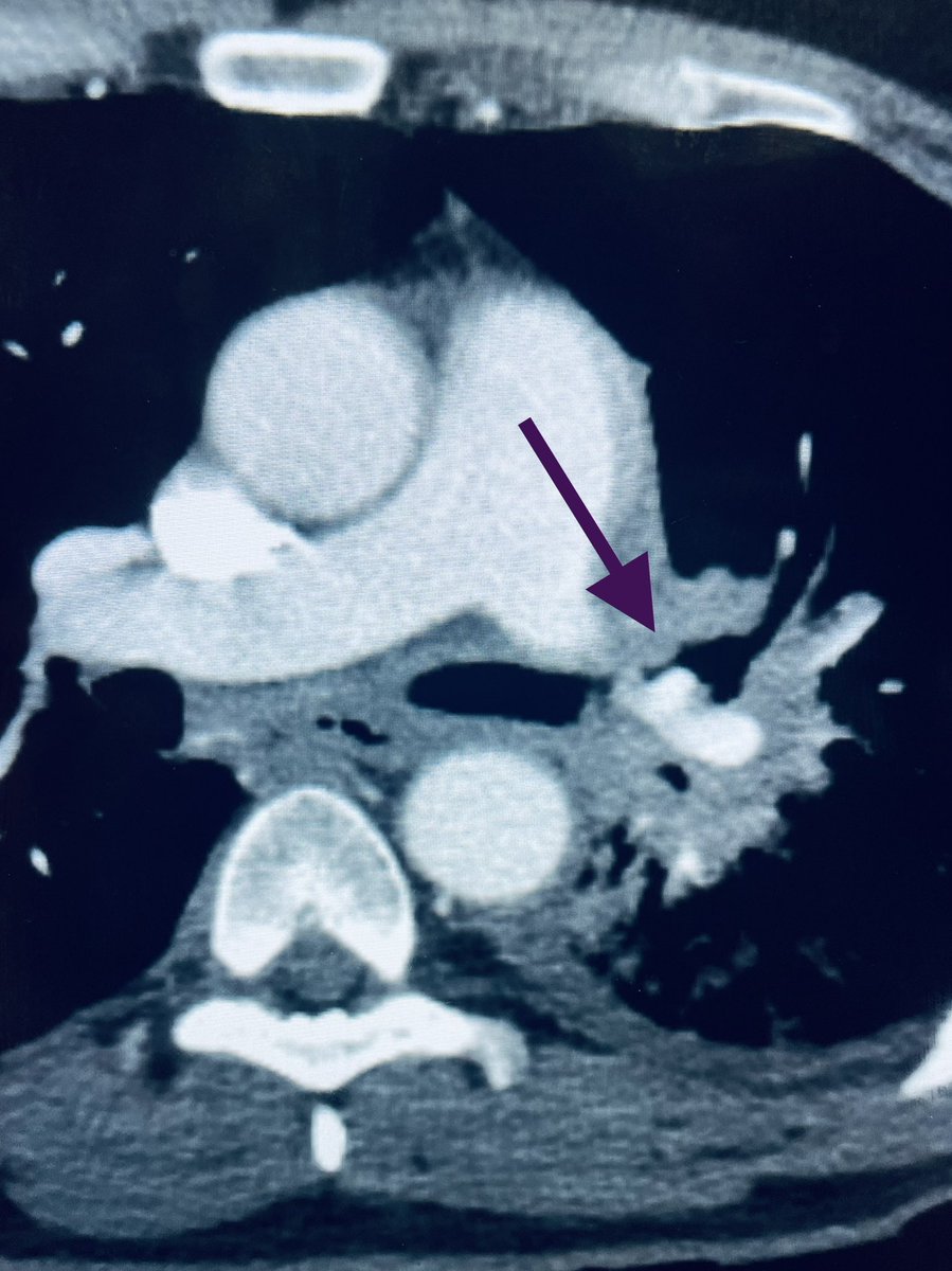 Venkat Tummala MD MBA tweet media