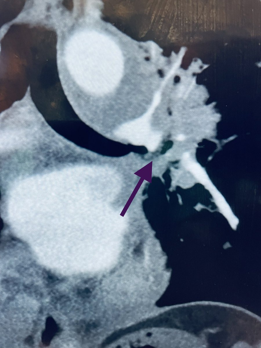 Venkat Tummala MD MBA tweet media