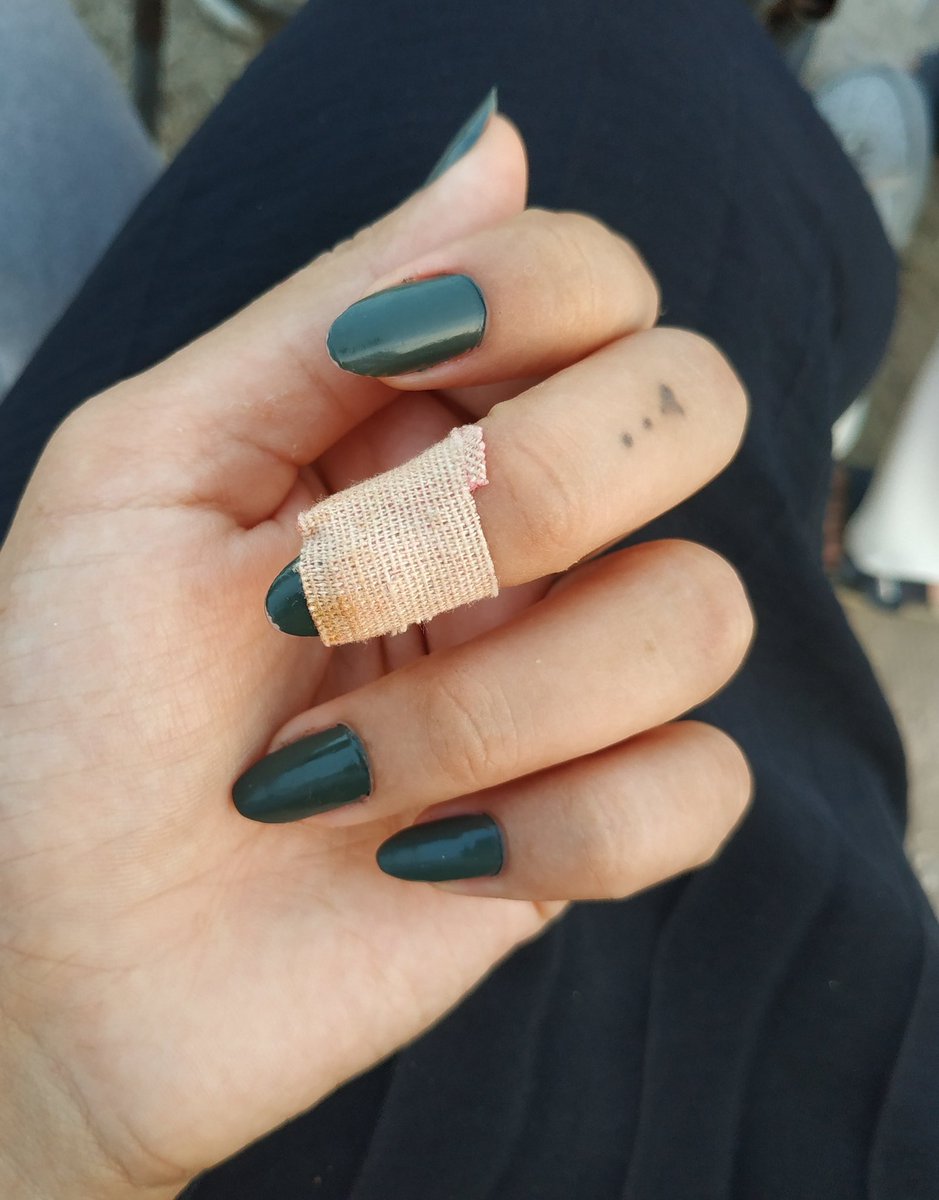 thedarkelff's tweet photo. Protez tırnağa ihtiyaç duymayacak kadar güzel tirnaklarim var diye işyerinde bol bol nazar ettiler ve sonunda ağır birşey kaldirayim derken tırnağımin dibinden kırılması 🥺🥺😢 https://t.co/V39BhHyP2Q
