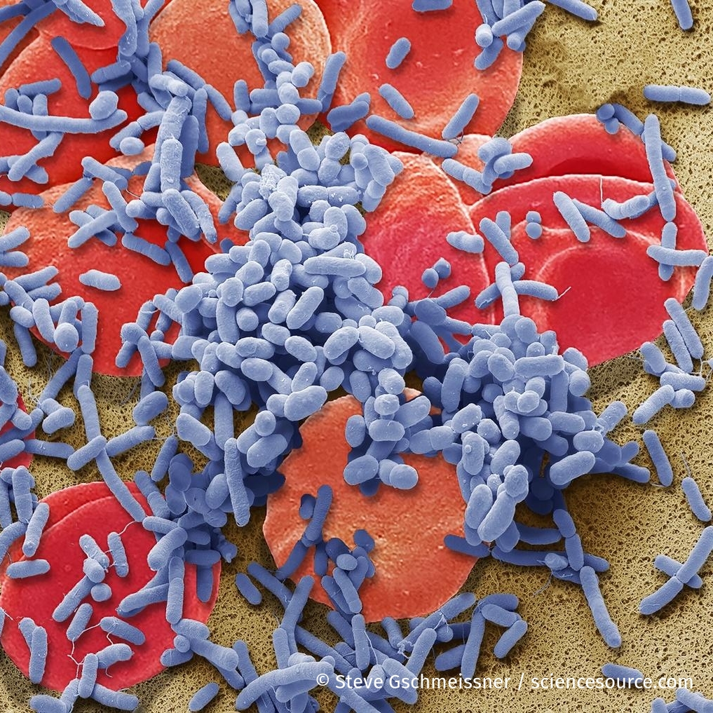 ScienceSource's tweet image. Sepsis 
Check out the article at @sciam with our sepsis image.
"Algorithm That Detects Sepsis Cut Deaths by Nearly 20 Percent" By @sophiebushwick
scientificamerican.com/article/algori…
Scanning electron micrograph. Bacteria amongst the red blood cells from the circulatory system.