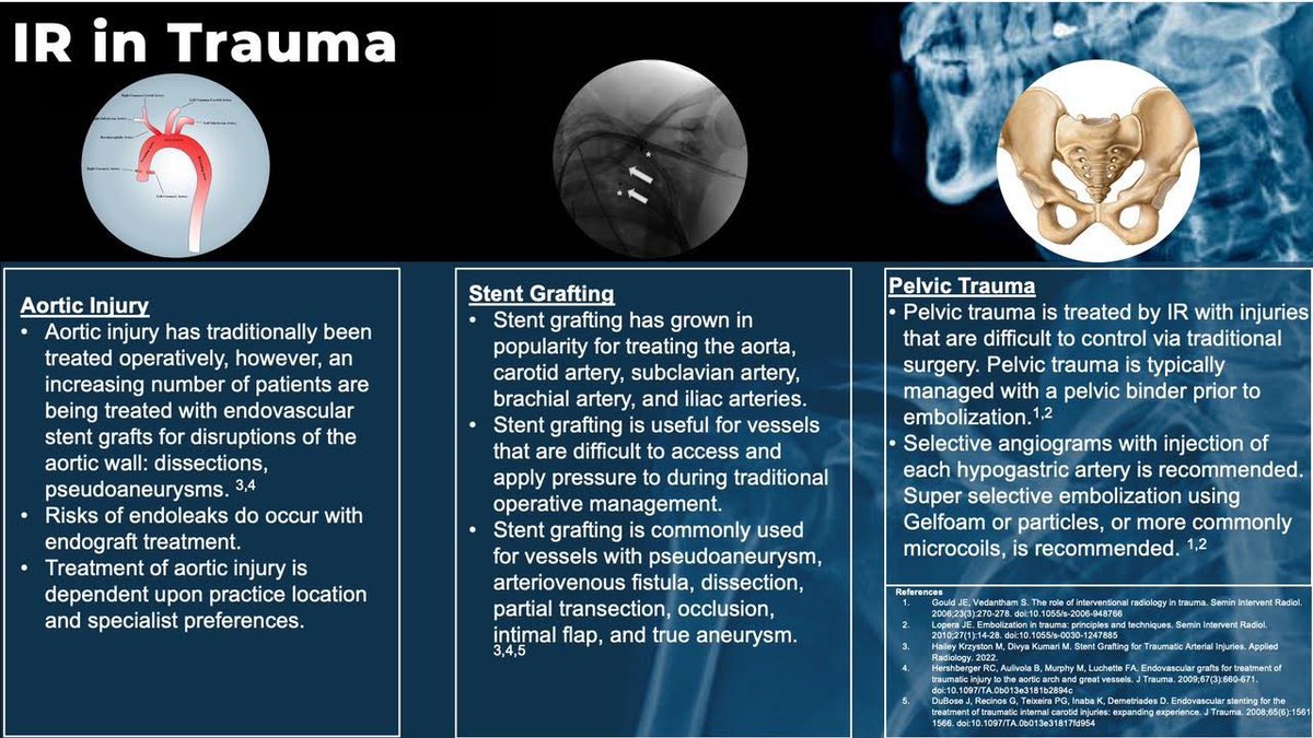 Check out this infographic on the role of IR in Trauma!

Created by:
- Medical Student Reserve: Kenneth D. Richardson <a href="/KenKenRichard/">Kenneth Richardson</a> 
- Attending Reviewer: Dr. Shree Venkat, MD
- SIR MSC Education Committee, Liaison: Tina Chatterjee <a href="/tinachatterje3/">Tonuka (Tina) Chatterjee, MD</a> 

#IR #iRad #MedEd #trauma