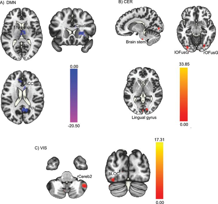 In our 7:2 issue, Lambert et al. provide evidence for positive outcomes of physical activity on fractional anisotropy and functional connectivity measures in adolescent and young adult cancer survivors.

Read this and other articles in the full issue: bit.ly/BPL7-2_mailing