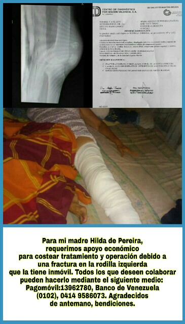 .#ServicioPúblico Para la madre de la profesora #UniVE Elisa Pereira se requiere con carácter de urgencia apoyo económico para costear tratamiento médico y operación producto de una fractura en la rodilla izquierda que la tiene inmóvil, cualquier aporte suma, gracias! #HCMUniVE