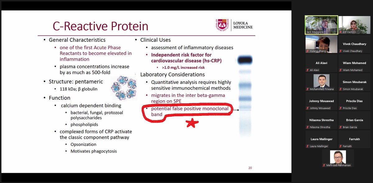 Did you know that high levels of CRP can cause a false positive monoclonal band on serum protein electrophoresis? Well, I just learned this today during @DocMaggiore 's amazing lecture. #TwitterHomework #PathElective @loyolapathology