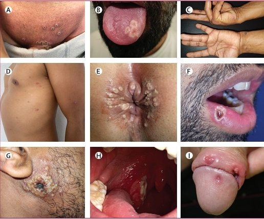 Michael Marks tweet media