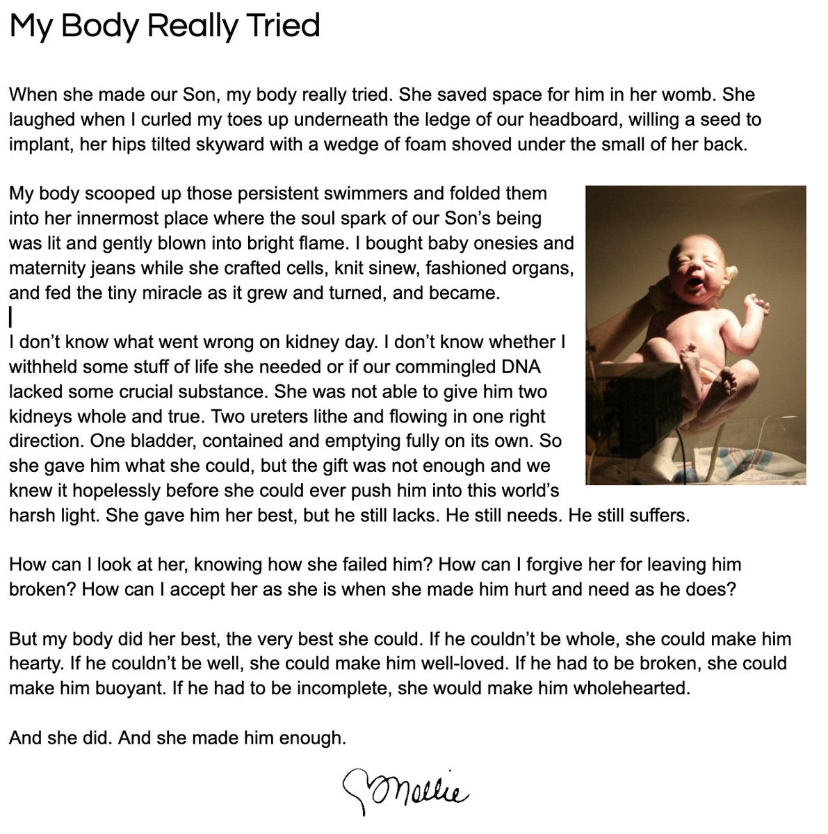 gofund.me/50009cf7

15 &amp; Living w/ Stage 4 Kidney Disease

When she made our Son, my body really tried... #CKD #kidswithCKD